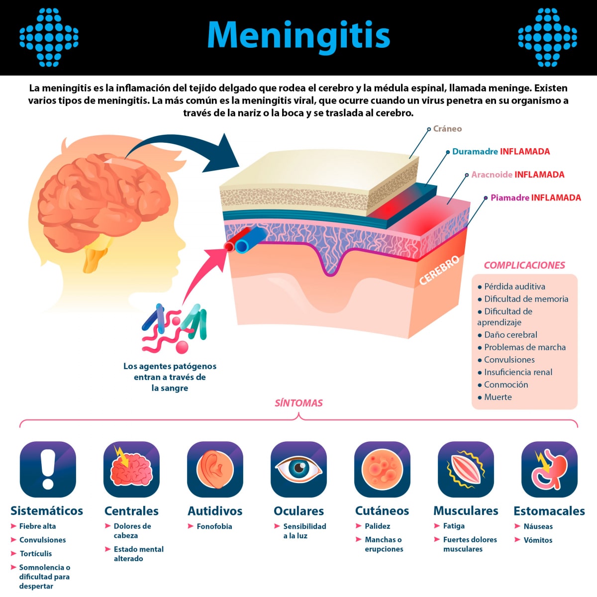 Que Es La Meningitis En Niños Y Sus Sintomas